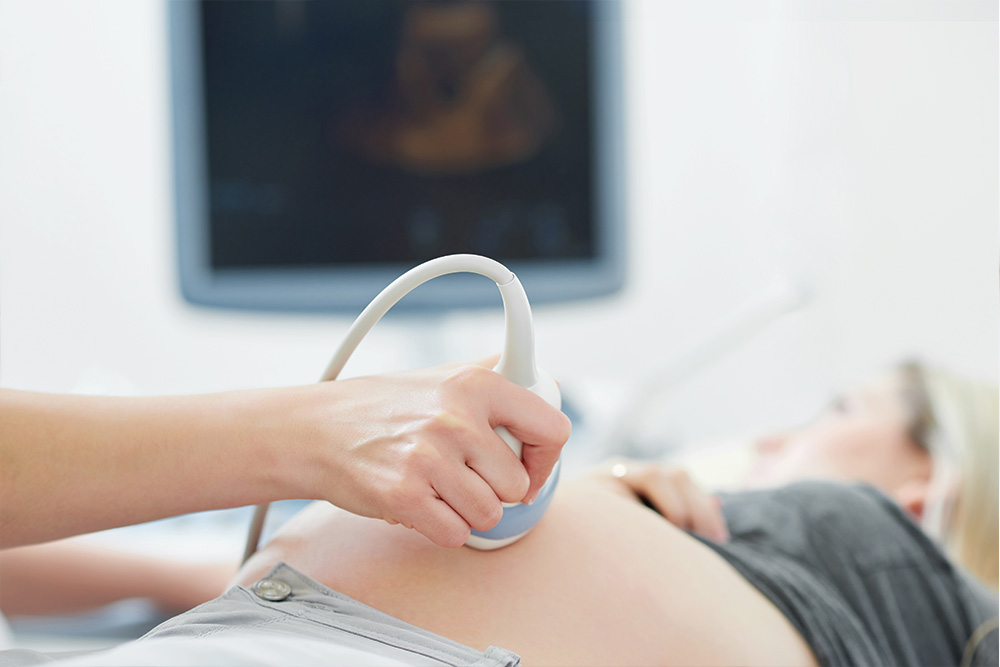 pregnant women receiving an ultrasound